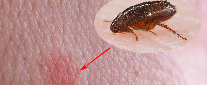 Flea Control for Humans Ontario, CA